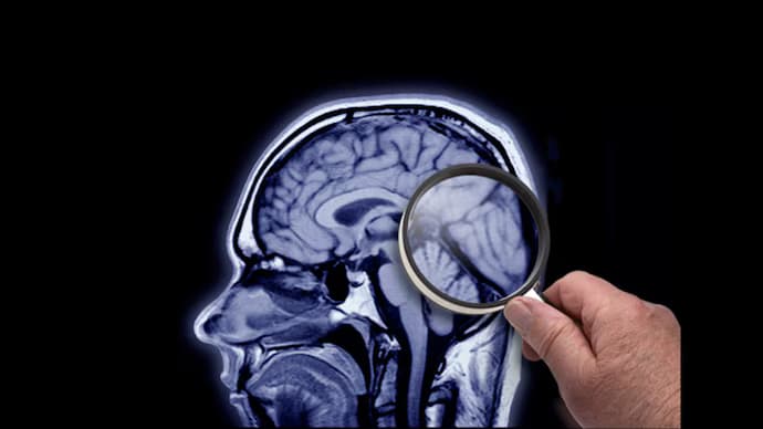 Innovative Research on Dementia in India