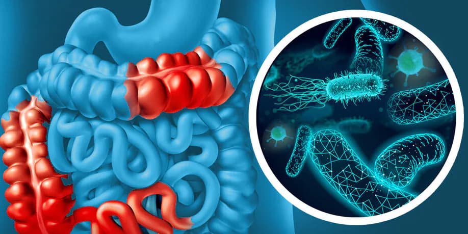 Unique Gut Microbiome in South Asians